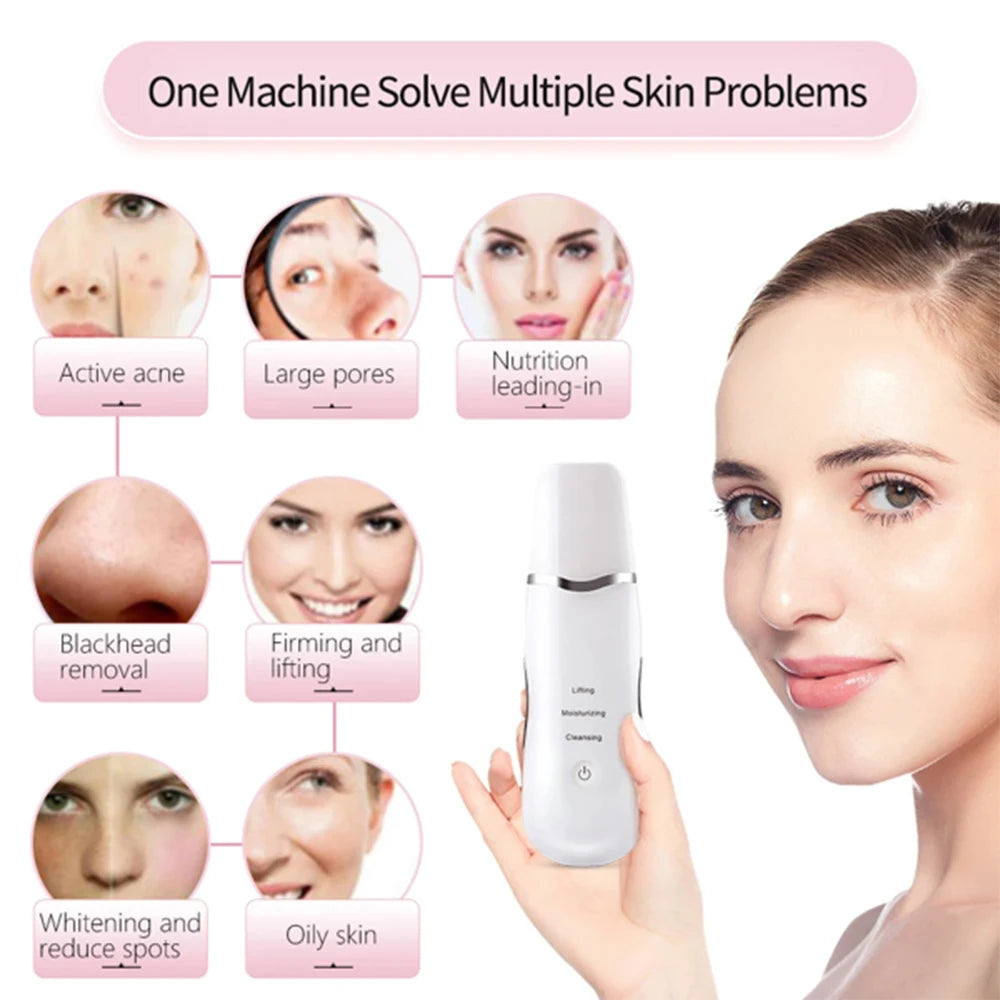 3-in-1 Ultrasonic Skin Scrubber Facial Cleanser Blackhead Remover