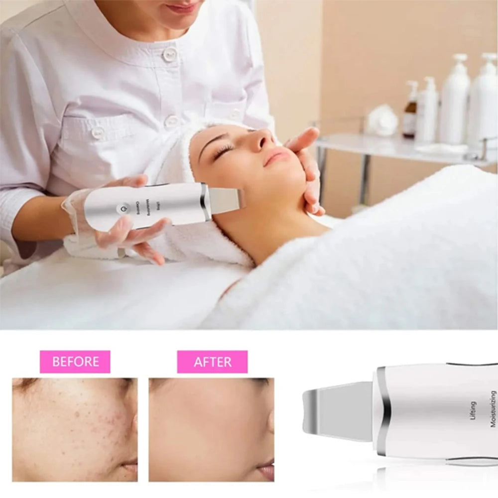 3-in-1 Ultrasonic Skin Scrubber Facial Cleanser Blackhead Remover