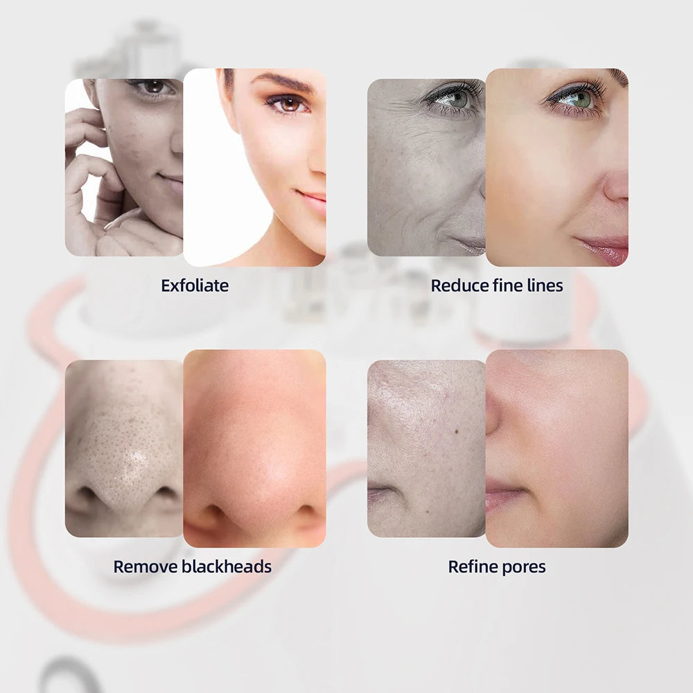 Professional 3 in1 Diamond Microdermabrasion Machine Water Spray Exfoliation Beauty Machine Removal Wrinkle Facial Peeling Tools