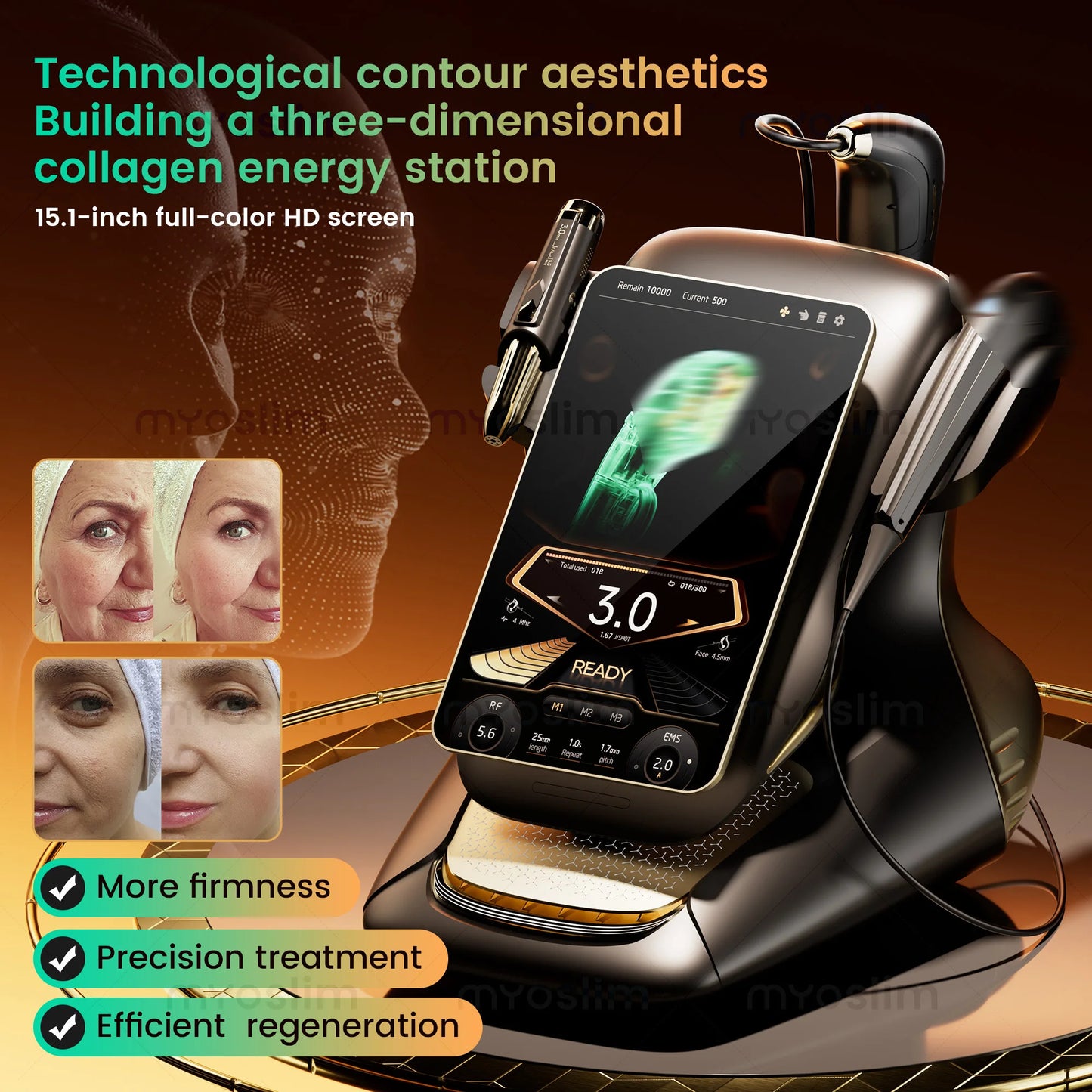 Portable 25D 360 Max Rf Lift Facial Lift Body Lift Skin Firming Anti-aging Skin Rejuvenation Firming Machine Salon.