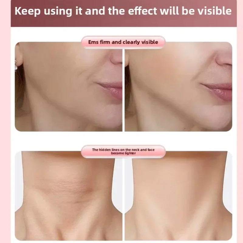 Roller Face Slimming Massager For Firming V Face Lift